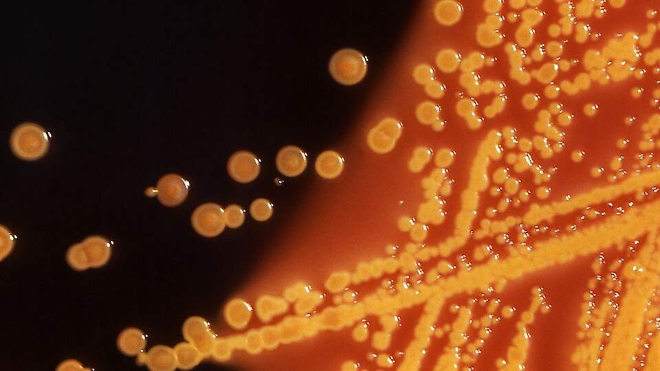 Antimicrobial resistance (AMR)
